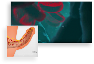 ed treatment tampa | Tampa Erectile Dysfunction