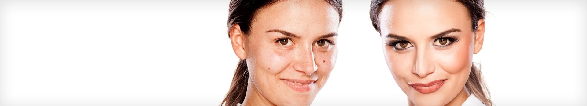 prp facial treatment